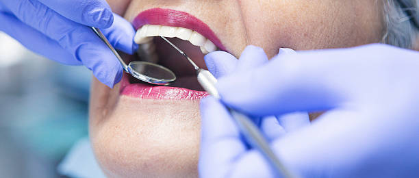 Best Emergency Wisdom Teeth Removal in Jasper, AL